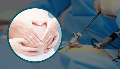 Fertility-Enhancing Surgery