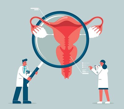 Best Fibroid Treatment Doctor in Vile Parle